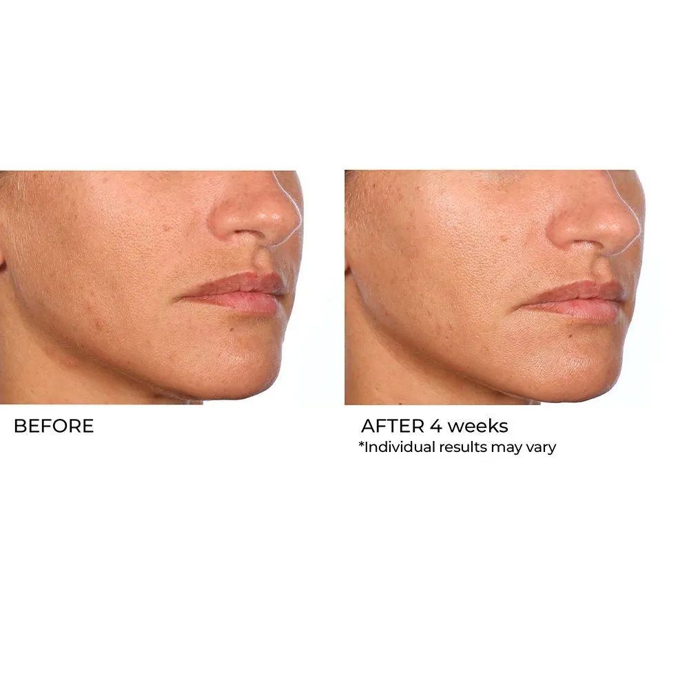 Even, Correct & Renew Retexturizing Pads - 30 Ct