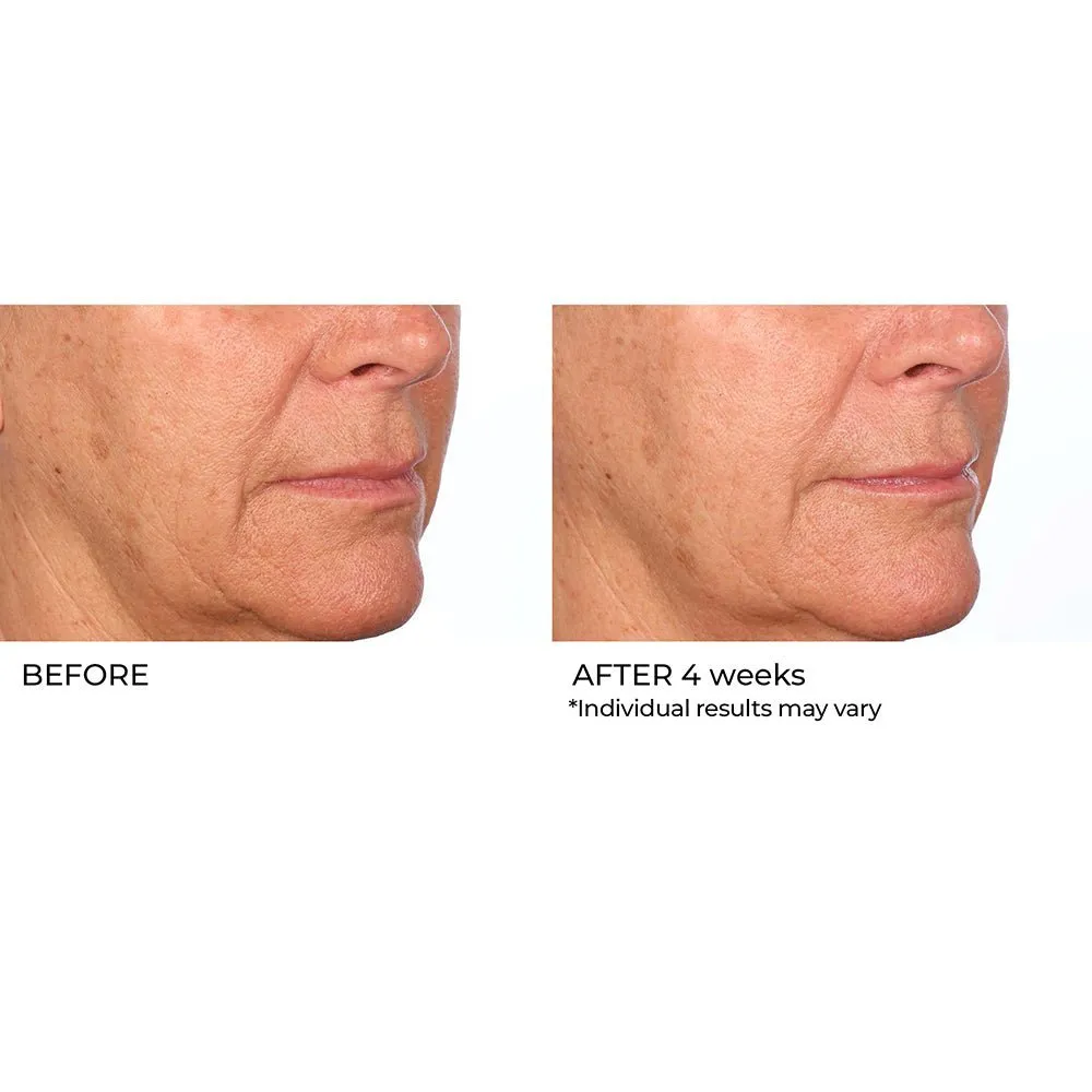Even, Correct & Renew Retexturizing Pads - 30 Ct
